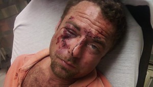 Aaron Parrish Beaten Police