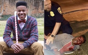 Martese Johnson Before After
